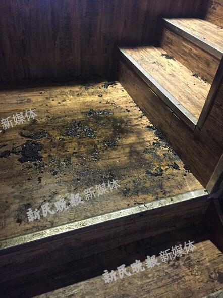 SNH48成員唐安琪遇意外嚴重?zé)齻? alt=