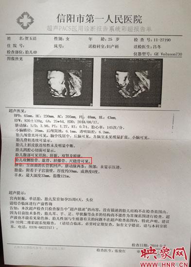 胎兒醫(yī)院四維彩超顯示一切正常 出生后肢體殘缺 胎兒醫(yī)院四維彩超顯示一切正常 出生后肢體殘缺