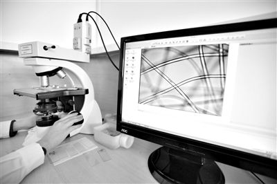 顯微鏡下，聚酯纖維很光亮，表面有斑點(diǎn)，粗細(xì)非常均勻。