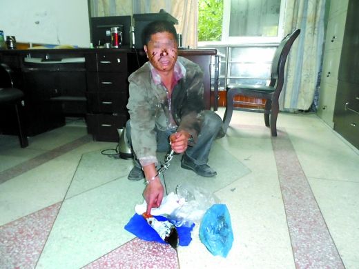   目前張遠已被刑事拘留。