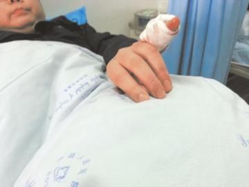 實(shí)習(xí)醫(yī)生陳洪左手的小拇指肌腱斷裂。