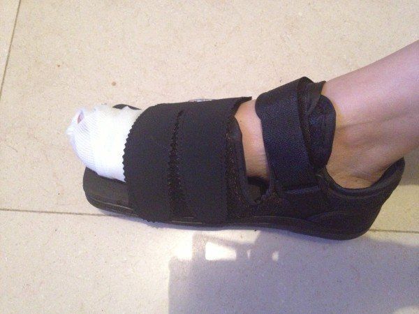 香港女星雨僑誤踢硬物腳趾骨裂錯失角色損失大 香港女星雨僑誤踢硬物腳趾骨裂錯失角色損失大