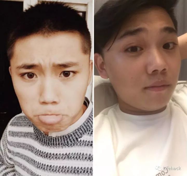 長胖20斤，臉型怎么變？這些例子看完扎心了！