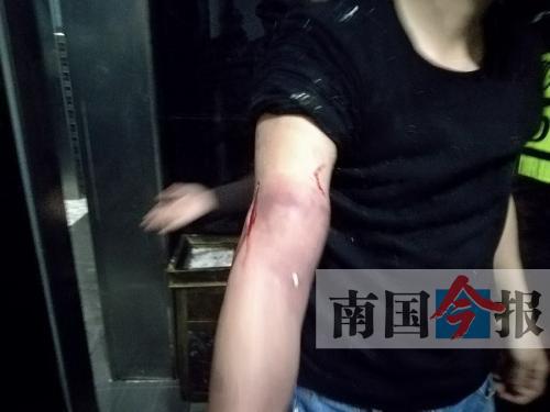 覃先生手臂被卡的部位受傷流血，所幸傷勢無大礙。 通訊員 王建民 攝