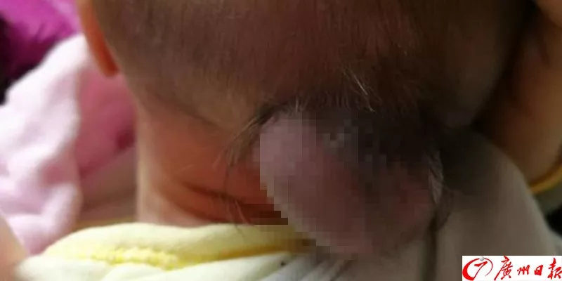 剛出生的男嬰腦袋上長(zhǎng)出尾巴 只因孕媽沒(méi)做這事 剛出生的男嬰腦袋上長(zhǎng)出尾巴 只因孕媽沒(méi)做這事
