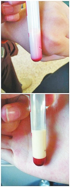 信陽(yáng)嬰兒患怪病血液呈乳白色 求助權(quán)威機(jī)構(gòu)查病因遭拒 信陽(yáng)嬰兒患怪病血液呈乳白色 求助權(quán)威機(jī)構(gòu)查病因遭拒