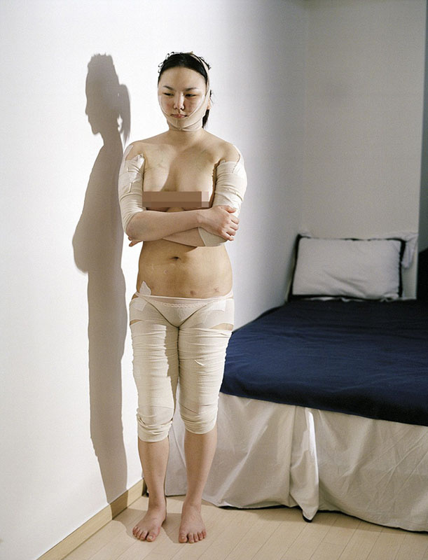 韓攝影師鏡頭記錄患者整容術(shù)后的生活 韓攝影師鏡頭記錄患者整容術(shù)后的生活