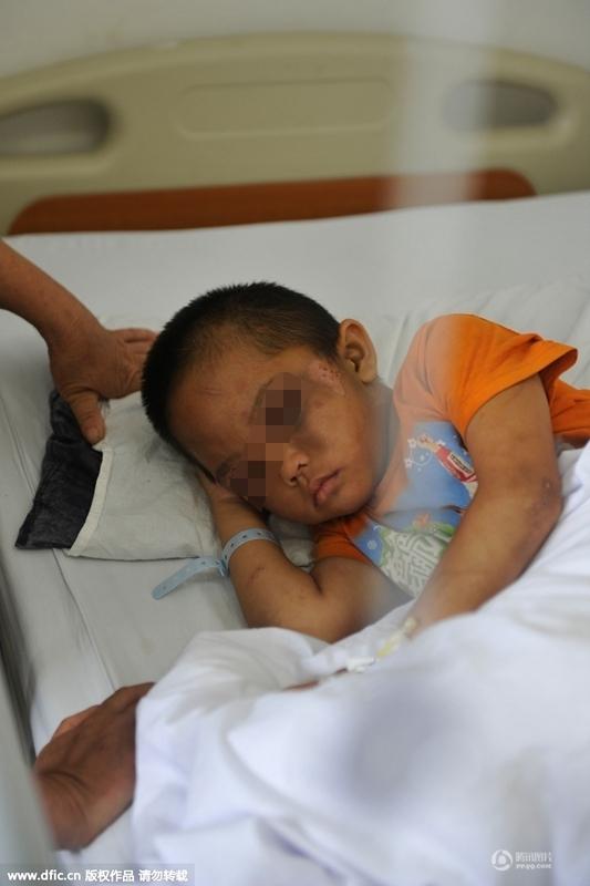 圖為全身傷痕累累的小進。