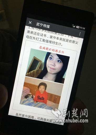 25歲少女患怪病“逆生長(zhǎng)” 半年矮了13厘米(圖) 25歲少女患怪病“逆生長(zhǎng)” 半年矮了13厘米(圖)